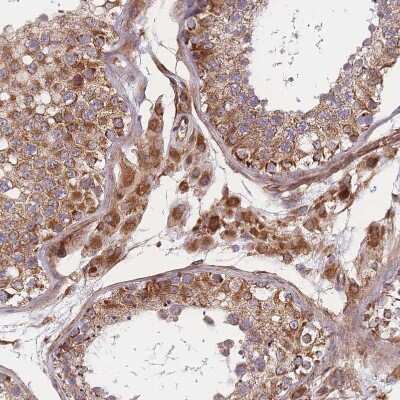 Immunohistochemistry-Paraffin: PRED31 Antibody [NBP2-14420]