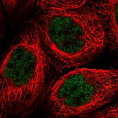 Immunocytochemistry/ Immunofluorescence: PRELID2 Antibody [NBP1-81937]
