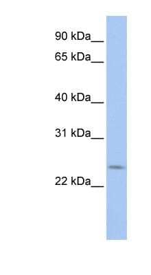 Western Blot: PRELID2 Antibody [NBP1-56751]