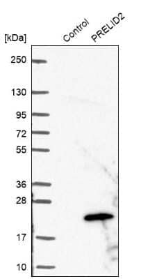 Western Blot: PRELID2 Antibody [NBP1-81937]