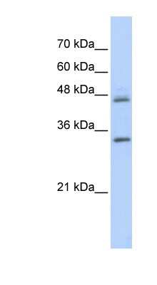 Western Blot: PRELP Antibody [NBP1-79627]