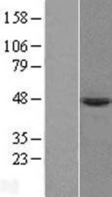 Western Blot: PRELP Overexpression Lysate [NBL1-14748]