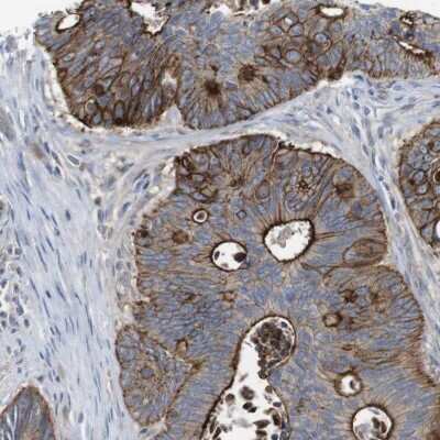 Immunohistochemistry-Paraffin: PREX2 Antibody [NBP1-84275]
