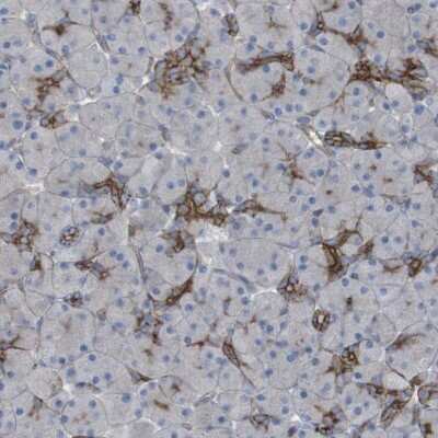 Immunohistochemistry-Paraffin: PREX2 Antibody [NBP1-84275]