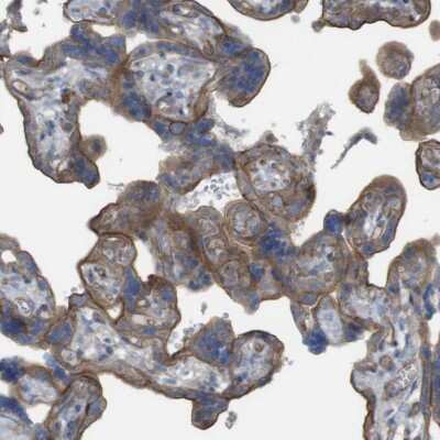 Immunohistochemistry-Paraffin: PREX2 Antibody [NBP1-84275]