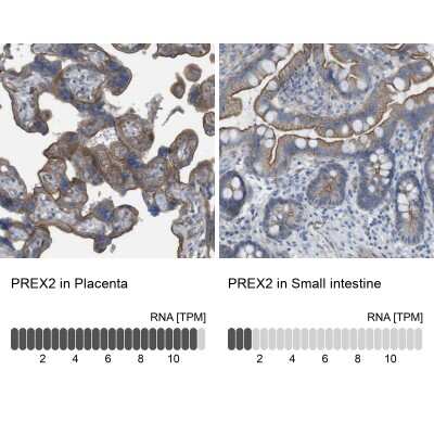 Immunohistochemistry-Paraffin: PREX2 Antibody [NBP1-84275]