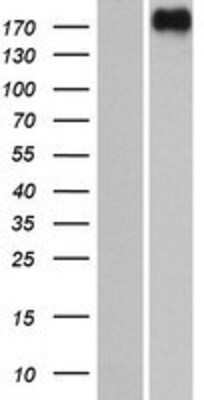 Western Blot: PREX2 Overexpression Lysate [NBP2-06278]