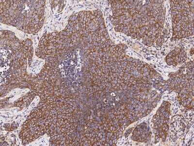 Immunohistochemistry-Paraffin: PRG-1/LPPR4 Antibody [NBP2-98915]