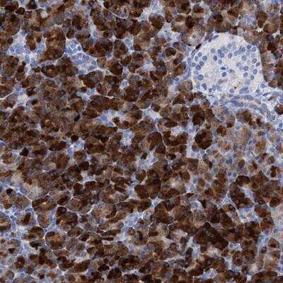 Immunohistochemistry-Paraffin: PRG-3 Antibody [NBP1-87570]