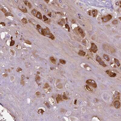 Immunohistochemistry-Paraffin: MBP-1 Antibody [NBP1-88573]
