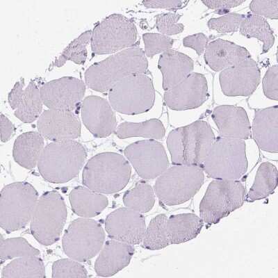 Immunohistochemistry-Paraffin: MBP-1 Antibody [NBP1-88573]