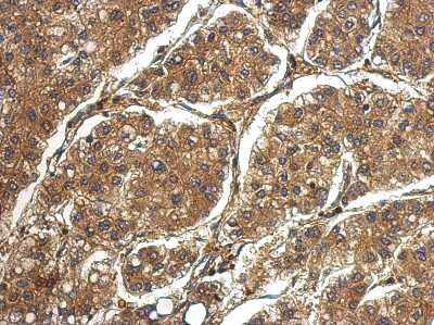 Immunohistochemistry-Paraffin: MBP-1 Antibody [NBP2-19928]