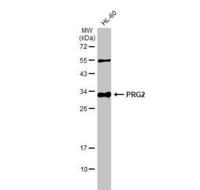 Western Blot: MBP-1 Antibody [NBP2-19928]