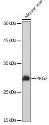 Western Blot: MBP-1 AntibodyAzide and BSA Free [NBP3-04784]