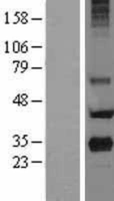 Western Blot: MBP-1 Overexpression Lysate [NBL1-14752]