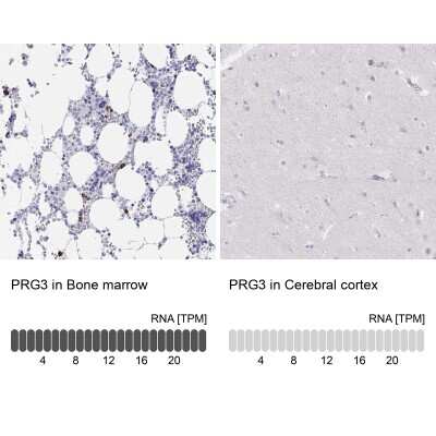 Immunohistochemistry-Paraffin: PRG3 Antibody [NBP2-38047]