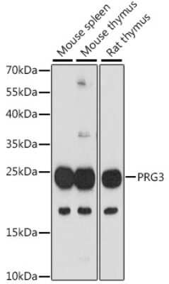 Western Blot: PRG3 AntibodyAzide and BSA Free [NBP2-94548]