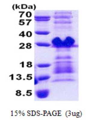 SDS-PAGE: Recombinant Human PRH1 His Protein [NBP2-23368]