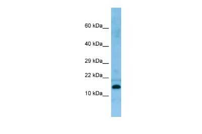 Western Blot: PRH2 Antibody [NBP3-09482]