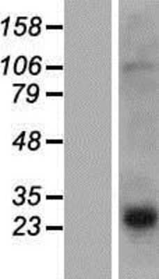 Western Blot: PRH2 Overexpression Lysate [NBP2-07799]