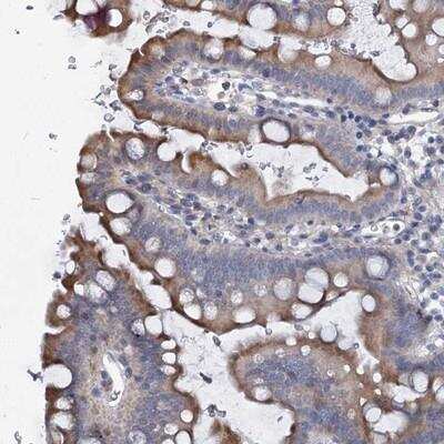 Immunohistochemistry-Paraffin: PRHOXNB Antibody [NBP1-90645]