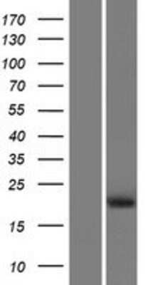 Western Blot: PRHOXNB Overexpression Lysate [NBP2-09360]