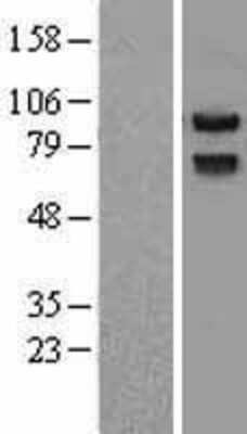 Western Blot: PRICKLE1 Overexpression Lysate [NBL1-14754]