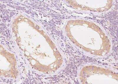 Immunohistochemistry-Paraffin: PRICKLE2 Antibody [NBP3-06515]