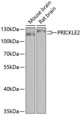 Western Blot: PRICKLE2 AntibodyBSA Free [NBP3-05610]