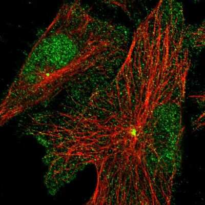 Immunocytochemistry/ Immunofluorescence: PRICKLE3 Antibody [NBP2-55605]