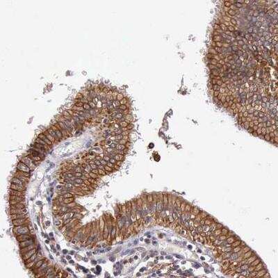 Immunohistochemistry-Paraffin: PRICKLE3 Antibody [NBP1-82830]