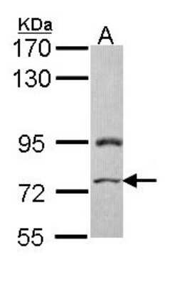 Western Blot: PRICKLE3 Antibody [NBP1-33511]