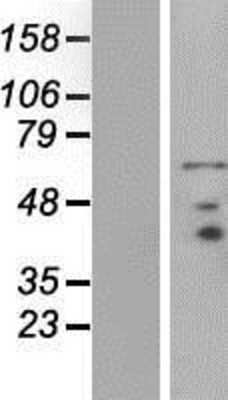 Western Blot: PRICKLE3 Overexpression Lysate [NBP2-07661]