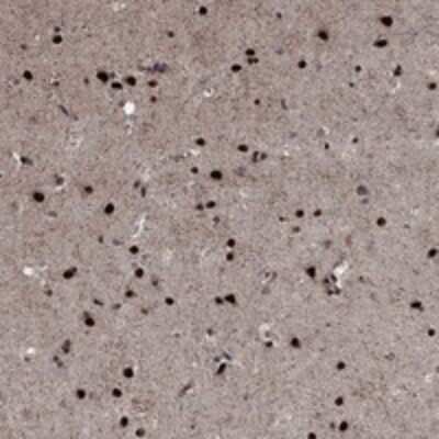 Immunohistochemistry-Paraffin: PRICKLE4 Antibody [NBP3-17613]