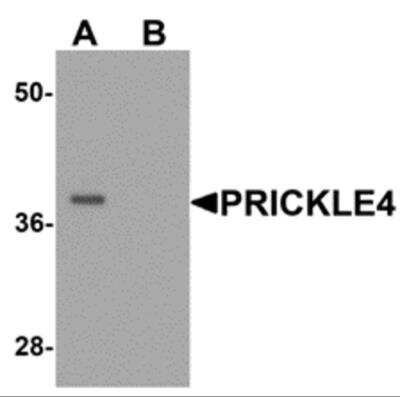 Western Blot: PRICKLE4 AntibodyBSA Free [NBP2-81939]