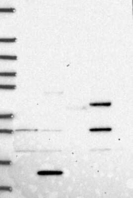 Western Blot: PRICKLE4 Antibody [NBP3-17613]