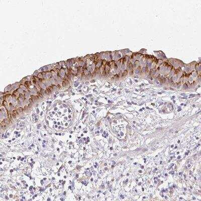 Immunohistochemistry-Paraffin: PRIMA1 Antibody [NBP2-32508]