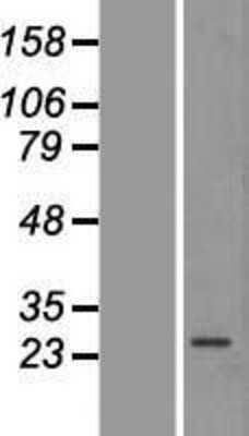 Western Blot: AMPK beta 2/PRKAB2 Overexpression Lysate [NBP2-07757]