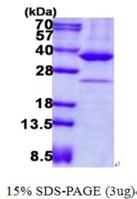 SDS-PAGE: Recombinant Human AMPK beta 2/PRKAB2 His Protein [NBP2-23376]