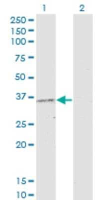 Western Blot: PRKAG2 Antibody (3C4) [H00051422-M01]