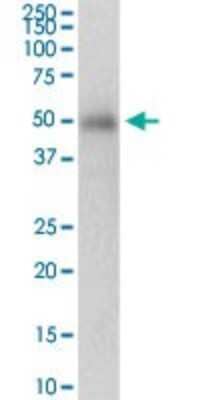 Western Blot: PRKAG2 Antibody [H00051422-D01P]