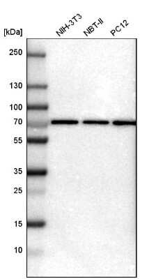 Western Blot: PRKAG2 Antibody [NBP1-89324]