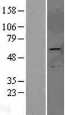 Western Blot: PRKAG2 Overexpression Lysate [NBL1-14761]