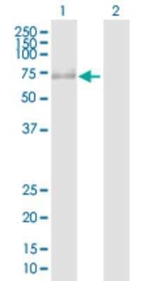 Western Blot: PRKAG3 Antibody [H00053632-D01P]