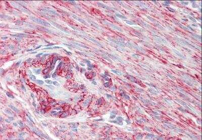 Immunohistochemistry-Paraffin: PRKCDBP Antibody [NBP1-45210]