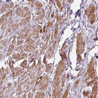 Immunohistochemistry-Paraffin: PRKCDBP Antibody [NBP2-47323]
