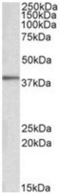 Western Blot: PRKCDBP Antibody [NBP1-45210]