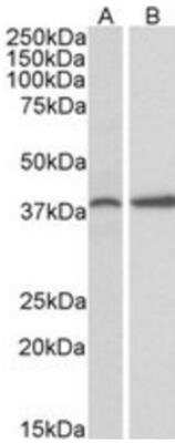 Western Blot: PRKCDBP Antibody [NBP1-45210]