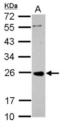 Western Blot: PRKCDBP Antibody [NBP2-19930]