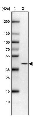 Western Blot: PRKCDBP Antibody [NBP2-47323]